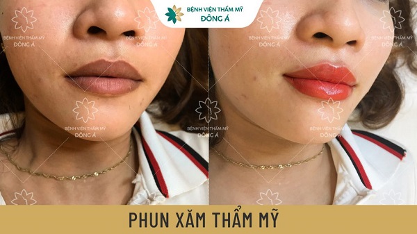 Bệnh Viện Thẩm Mỹ Đông Á