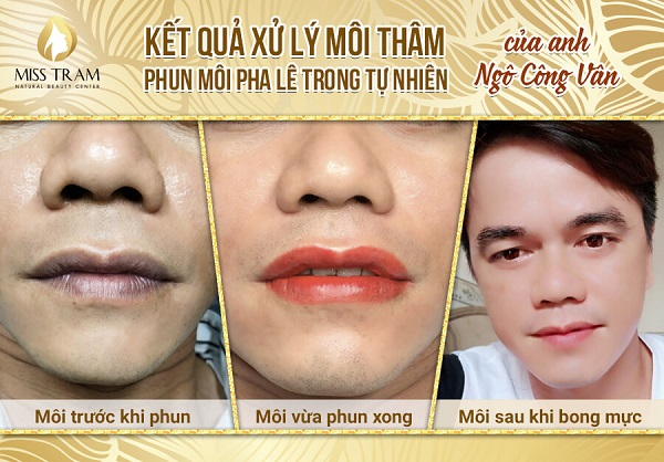 Thẩm mỹ viện Miss Tram Natural Beauty Center